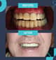 Slider image (10) Dr. Aleksandar Kovacevic - Dental Clinic in Croatia